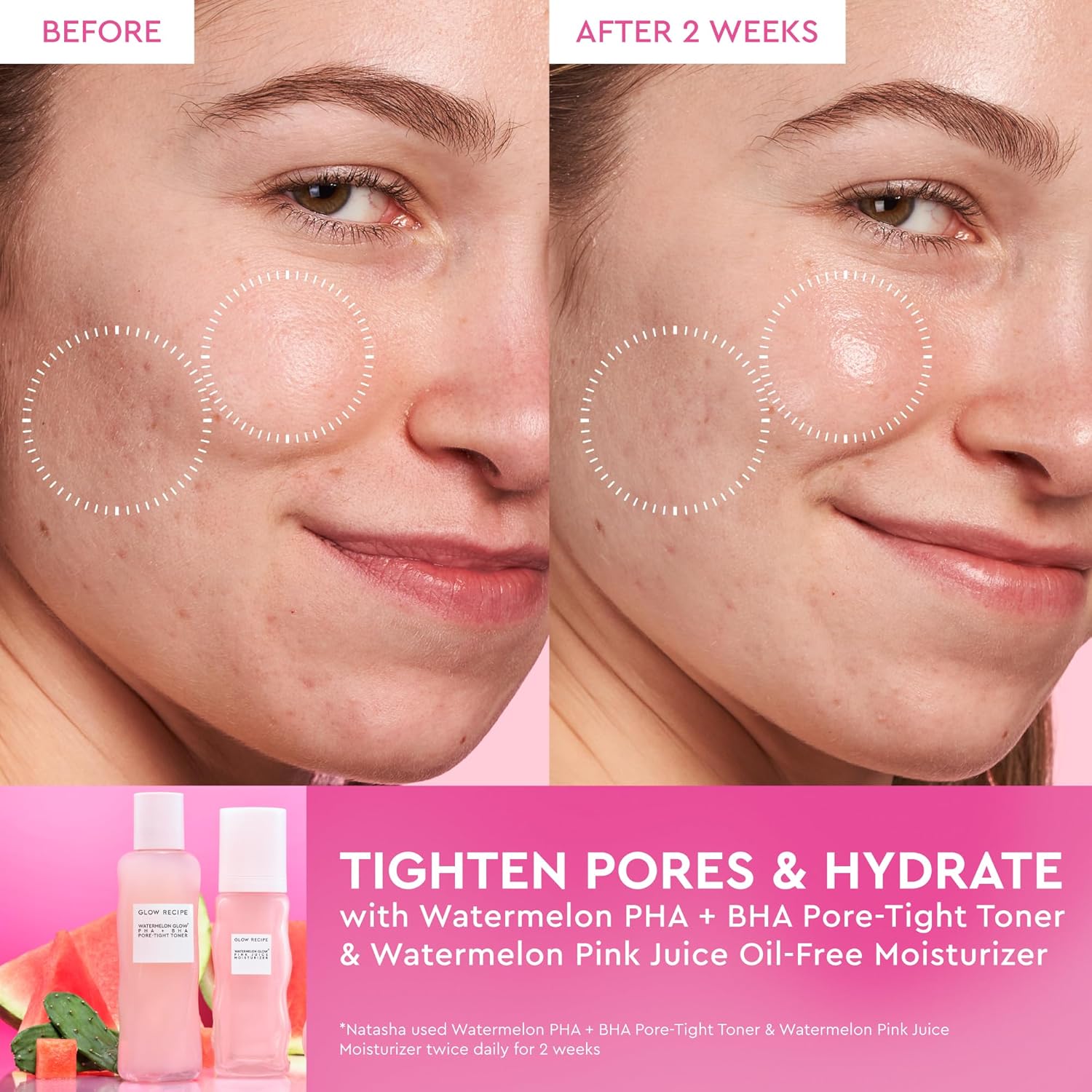 Revitalize Your Skin with Pink Juice Water Gel Moisturizer - The Ultimate Korean Hydrating Solution for a Glassy, Glowing Complexion!